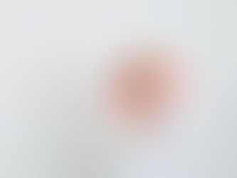 Understanding Panic Attacks and Panic Disorder: Causes, Symptoms, and Treatments