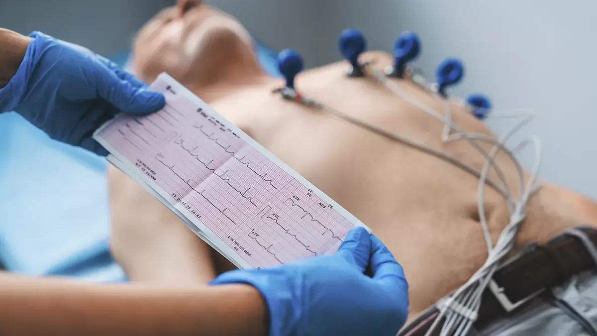 Eletrocardiograma