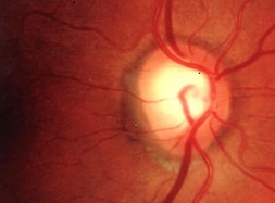 retina