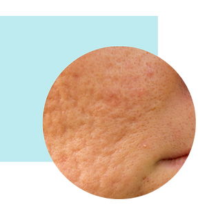 block 3 b.png