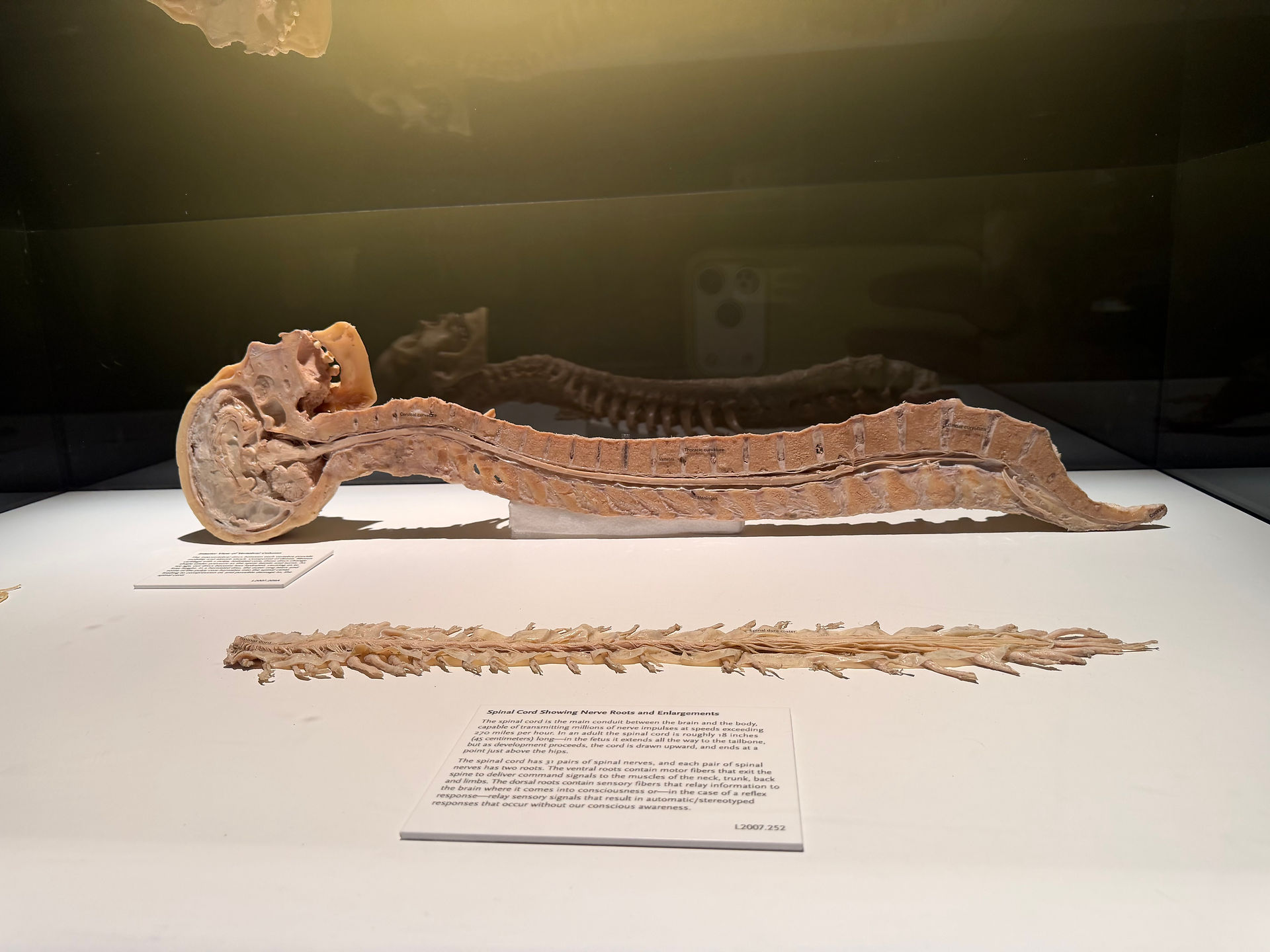 side splice of central nervous system: brain and spine cross-section
