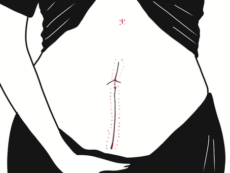 prototipagem 12. animação 3 - endometriose. ilustrações.