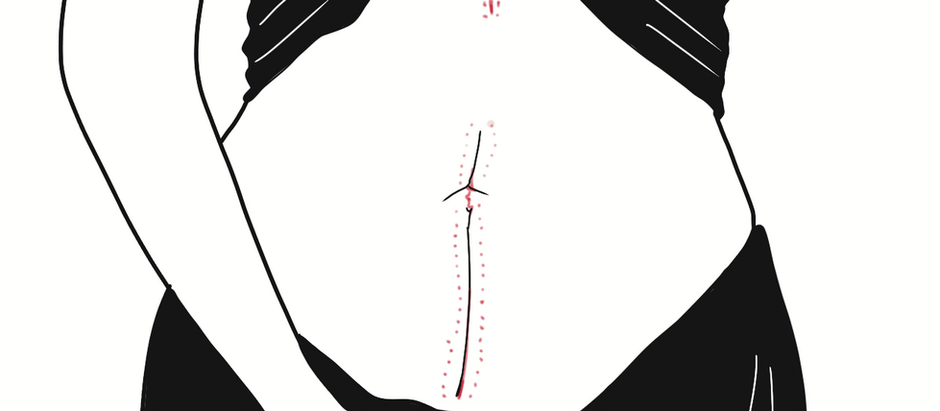 prototipagem 12. animação 3 - endometriose. ilustrações. 