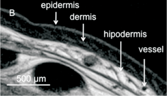 MR Histology: Skin Layers