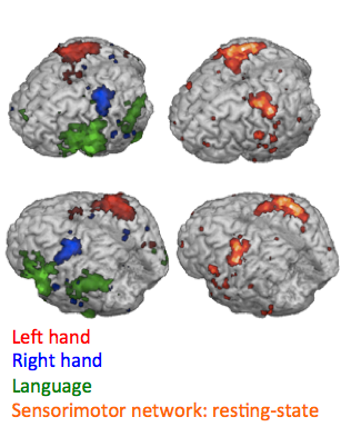 Task-based and Resting State fMRI