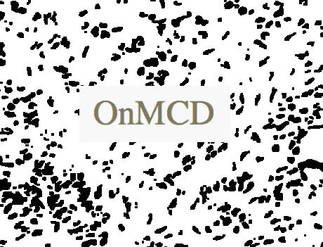 OnMCD