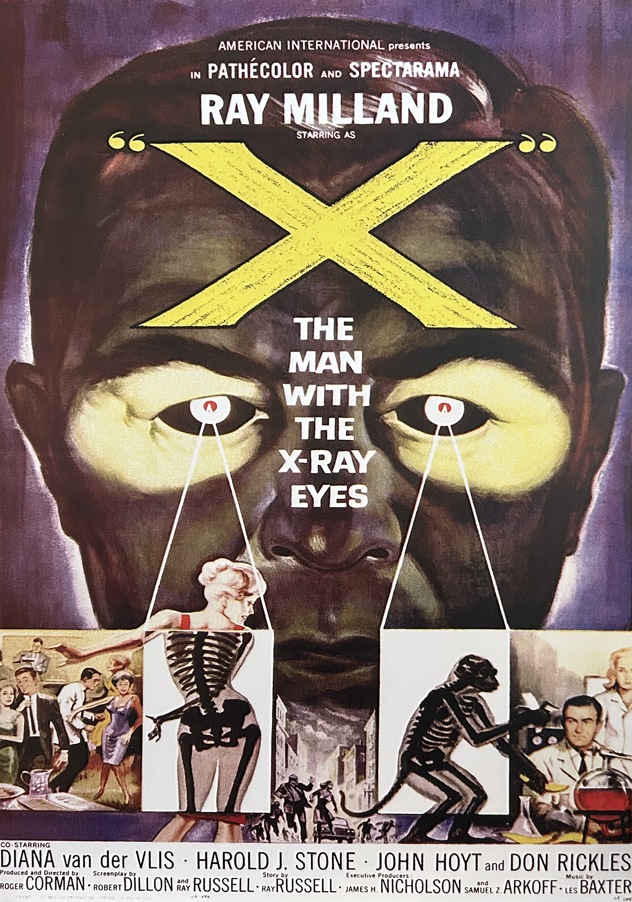 The Man With the X Ray Eyes