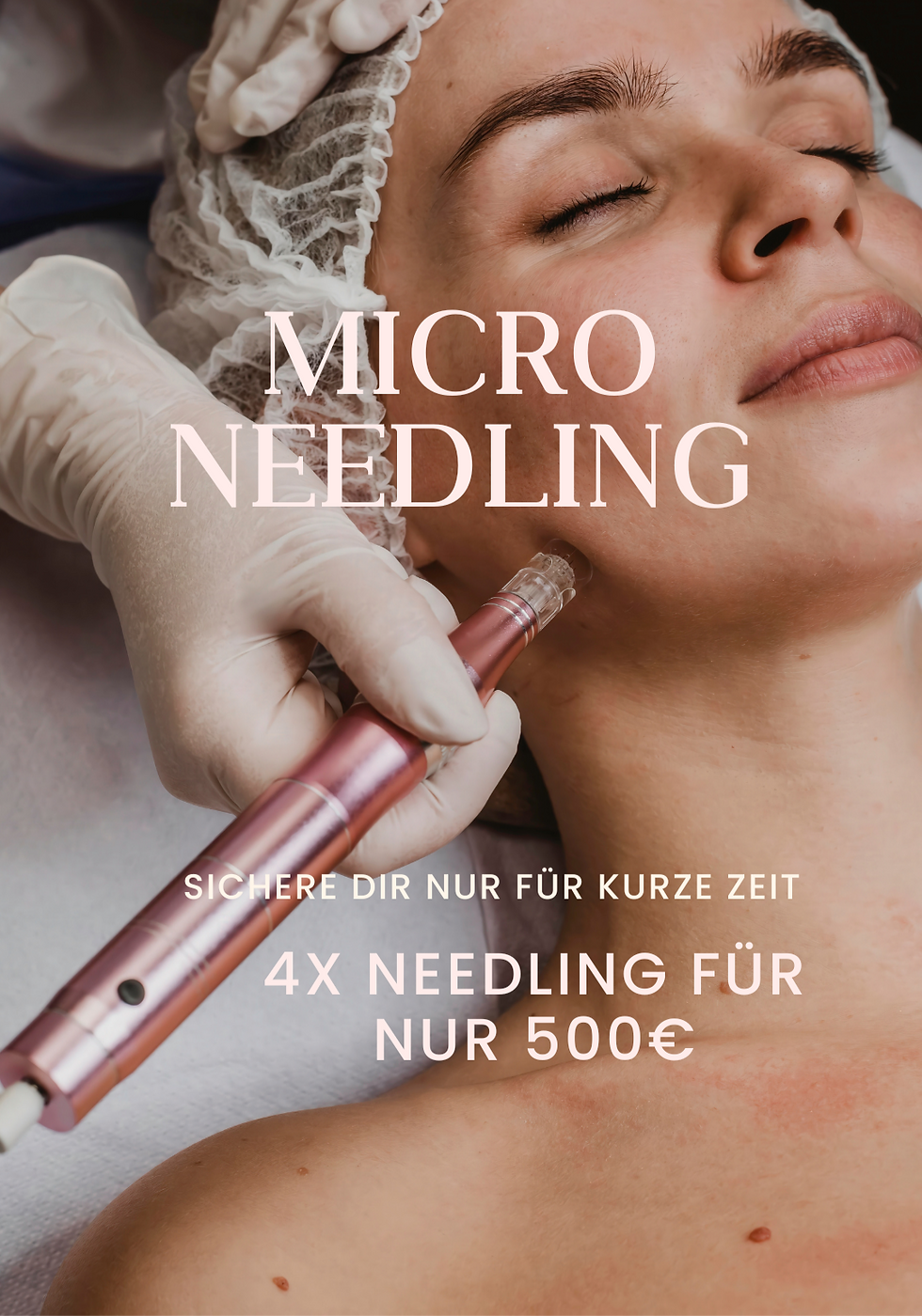 Needling Kur