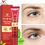Miniatura: Collagen Peptide Eye Cream Hyaluronic Acid Anti Wrinkle Anti Aging Gel Hydrate D
