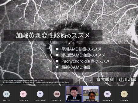 第15回筑後黄斑疾患研究会 (9/2:Web開催)のご報告