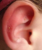 oreille enfant.png