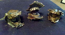 Teeth1