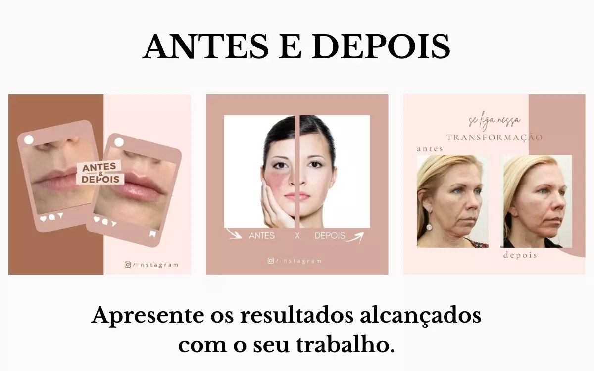 pack estética (5).webp