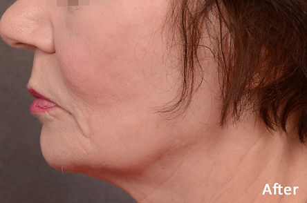 FORMA_Dr.-B.-Ridenour_Before2.jpg