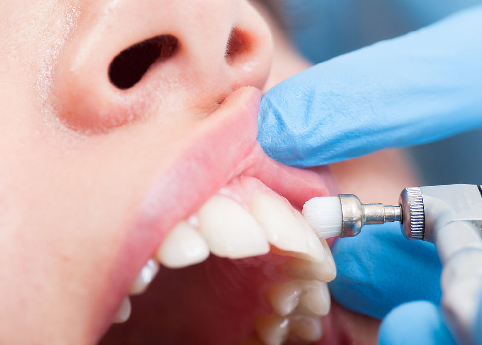 Professionelle Zahnreinigung