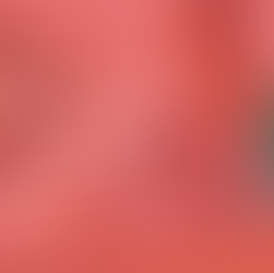 Webinar: Silence Therapeutics and Their Work with MPNs