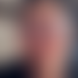 Oscar Wei, Living with Essential Thrombocythemia and Traditional Chinese Medicine