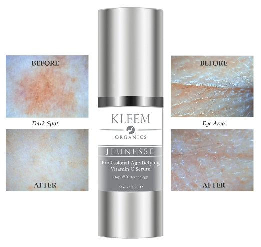 Thumbnail: Kleem Organics