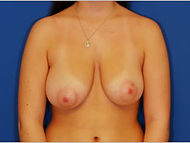 Case 13 before 1.jpg