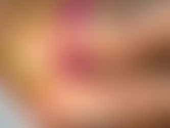 PIEDI SECCHI: PREVENZIONE E RIMEDI