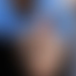 The “It Girl” Identity Crisis in The Age of Rhinoplasty and Social Media 