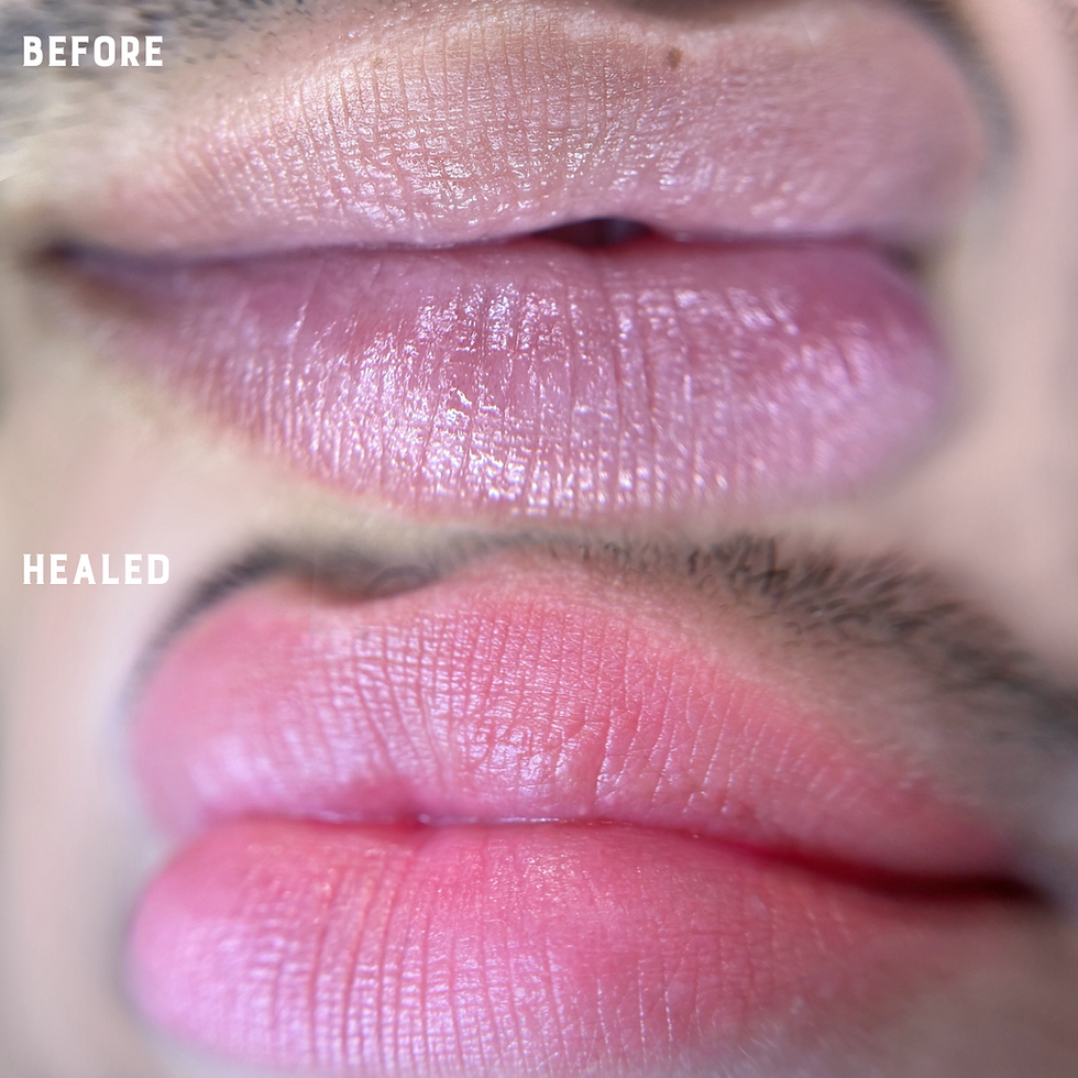 Before and After of Lip Blush