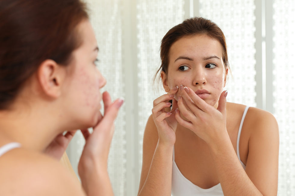 Girl looking in the mirror and picking her acne
