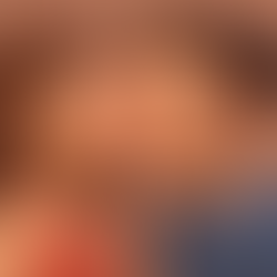 Droom Over Naaldjes In Je Tong (Met Bloed) En Daarna Zoenen Met Een Knap Persoon