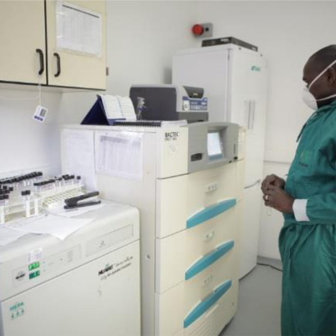 INICIA NOVO ESTUDO SOBRE O DIAGNÓSTICO DA TUBERCULOSE E HIV