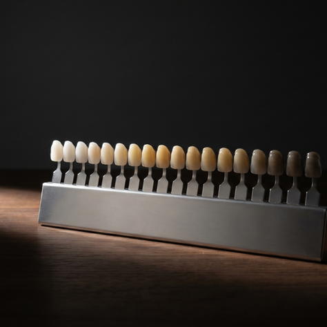 Pourquoi les dents jaunissent : causes, prévention et solutions