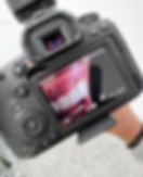 Photographie clinique standardisée d'un cas avant après en cours de prise de vue au cabinet du Dr Bruno Abehassera à Levallois-Perret