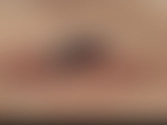 Em Palmeira 24 casos de Dengue foram confirmados até última sexta-feira (19)