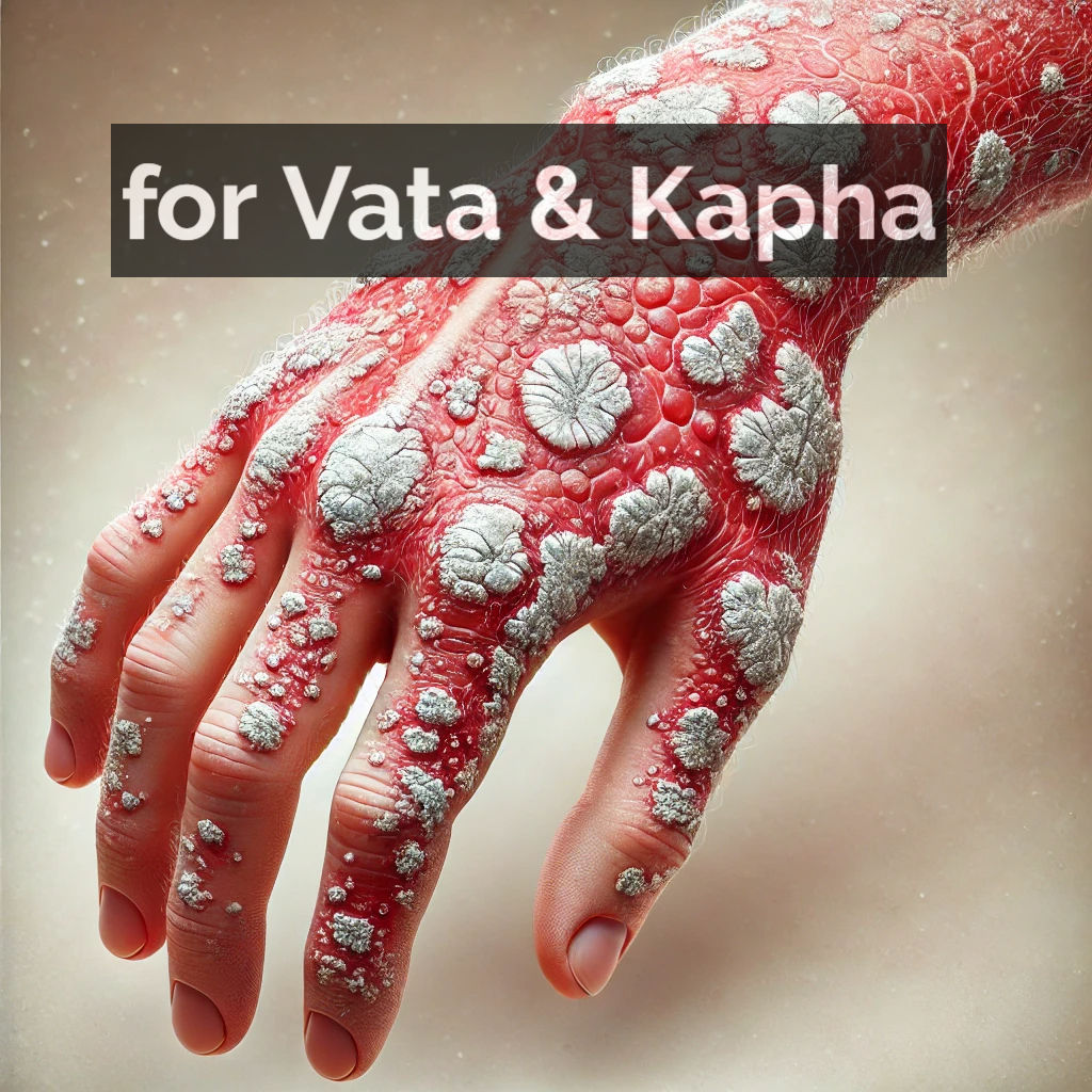 Vaid Rubal's Vata & Kapha Psoriasis Formula
