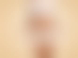 Mini Abdominoplasty Recovery Stages and Milestones