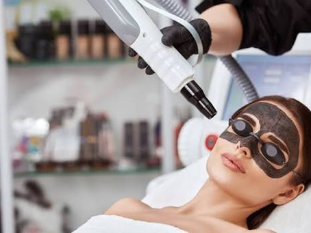 Laser Carbon Peel: Everything You Need Before Trying It