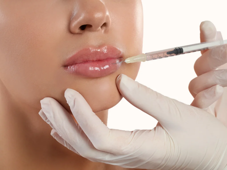 Why Russian Lip Fillers Trend Worldwide