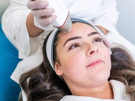 Fractional RF Microneedling for Youthful Skin