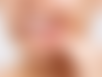 Does Gum Bleeding Treatment Require a Diagnosis?