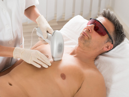 Best Laser Hair Removal Methods for Lasting Skin Care