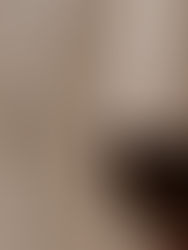 Effetti di fumo e alcol sulla salute orale: cosa succede davvero a denti, gengive e bocca?