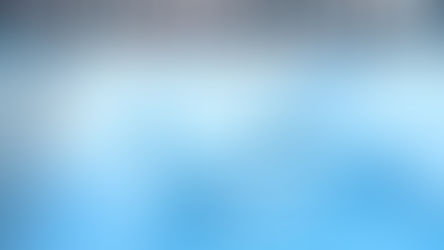 RMN de cerebro con difusión/perfusión 