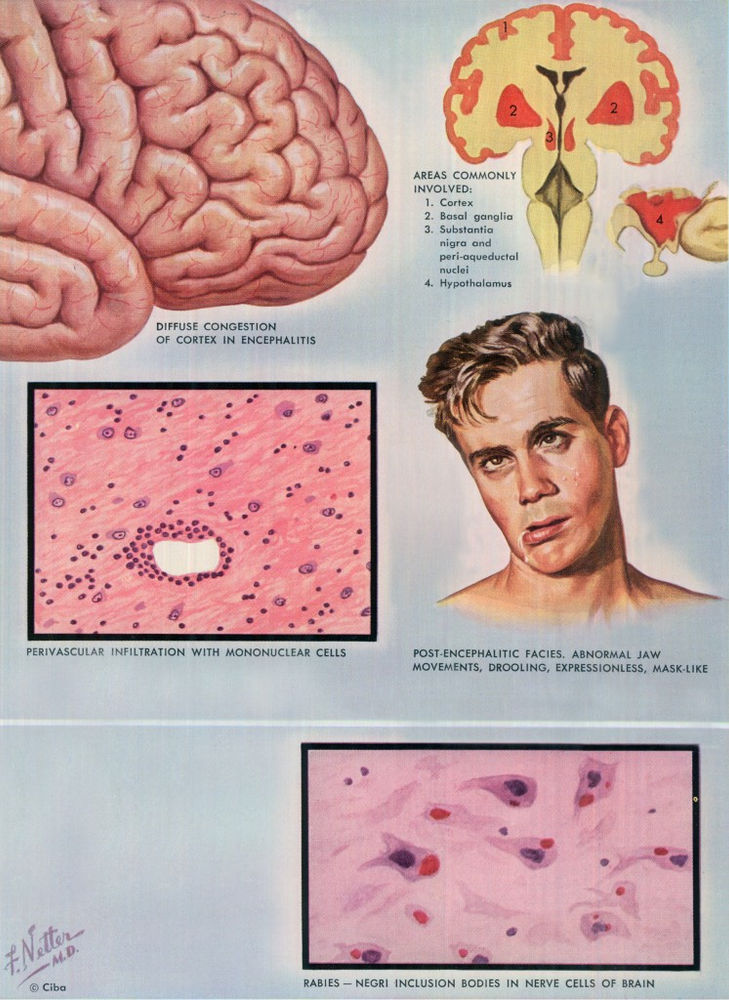 Doctoring The Craft Of Medical Illustration – The Work Of Frank H