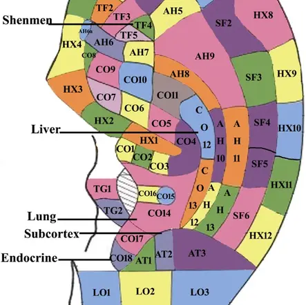Auricular acupressure controlled post-operative cesarean pain and reduced need for analgestics