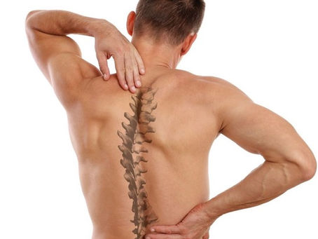 Scoliosis: What is it?