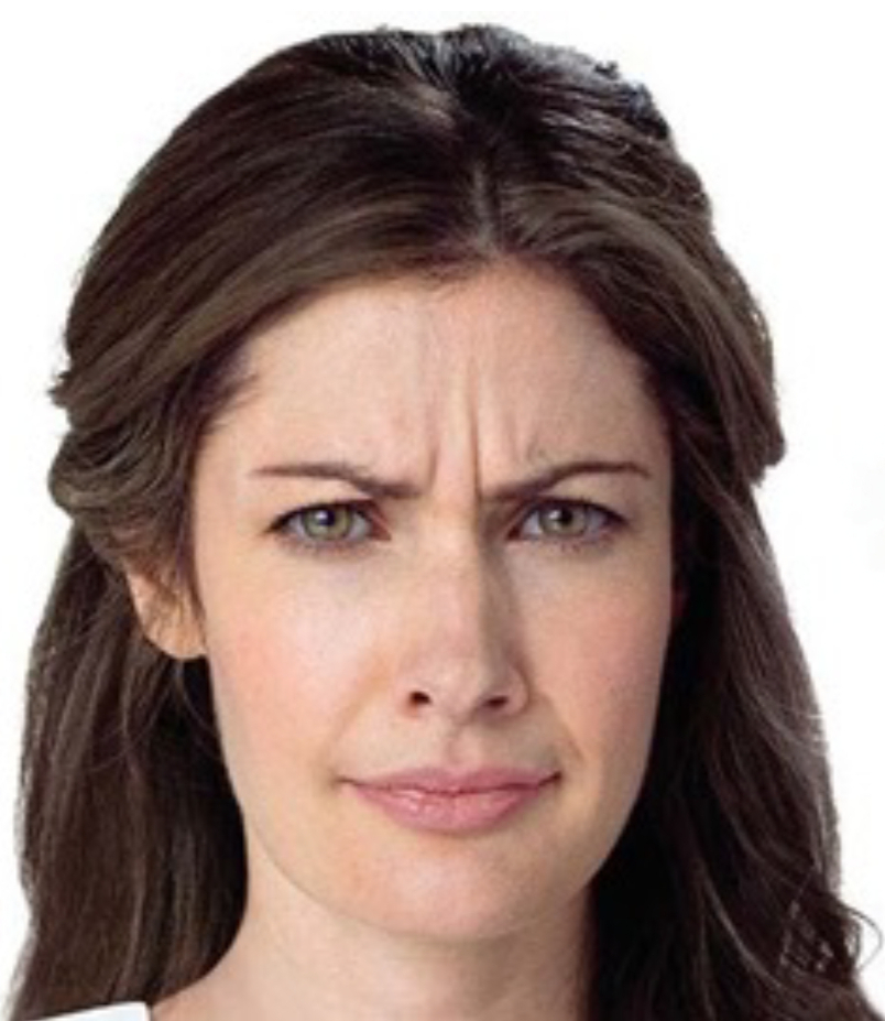 Frown Lines (Glabellar Lines) | Epicare Health