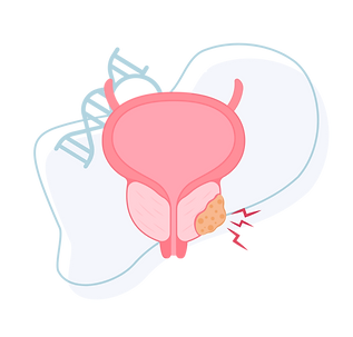 Genetic Prostate Cancer Risk