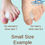 Thumbnail: Chiroplax Gel Toe Spacers Separators Toe Spreader Straightener for Bunion Pain Relief