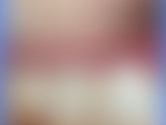 Le white spots, cioè le macchie bianche sui denti, cosa sono?