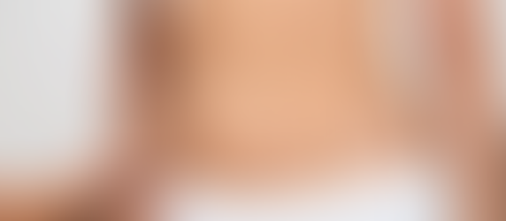 How long is recovery after Lipo Abdominoplasty surgery?