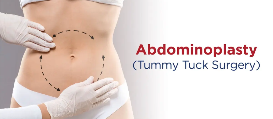 How Do You Prepare for Lipo Abdominoplasty Surgery?